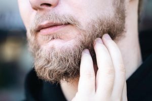Beard Itch